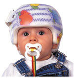 Vista de un bebé con un casco Starband